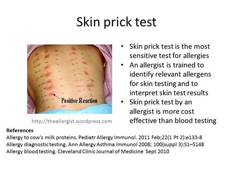 blood pressure dropped during scratch allergy test|allergy skin test interpretation.